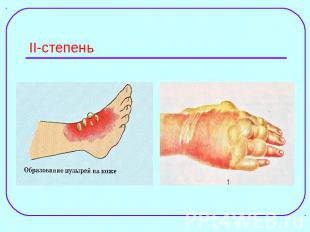 II-степень