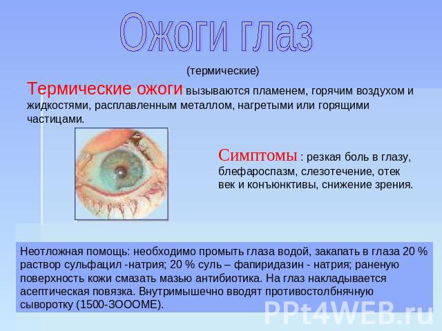 Ожоги глаз Термические ожоги вызываются пламенем, горячим воздухом и жидкостями, расплавленным металлом, нагретыми или горящими частицами. Симптомы : резкая боль в глазу, блефароспазм, слезотечение, отек век и конъюнктивы, снижение зрения.  Неотложн…