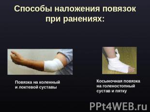 Способы наложения повязок при ранениях: Повязка на коленный и локтевой суставы К