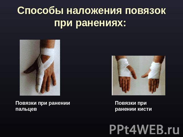 Способы наложения повязок при ранениях: Повязки при ранении пальцев Повязки при ранении кисти