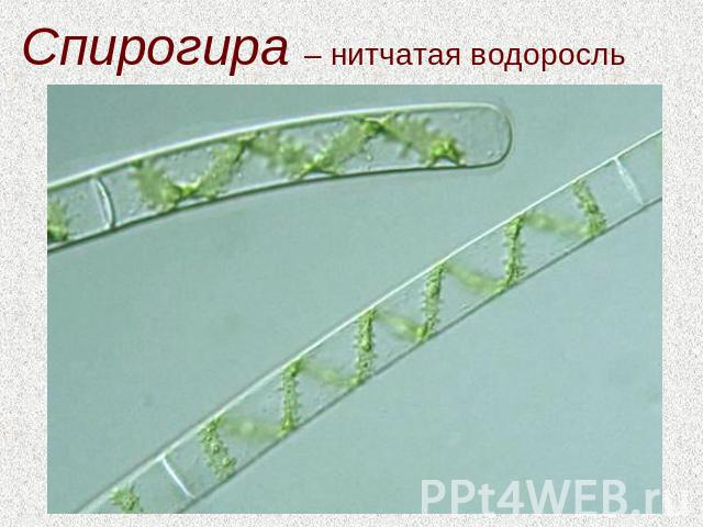 Спирогира – нитчатая водоросль