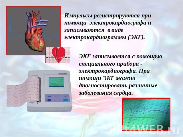 Импульсы регистрируются при помощи электрокардиографа и записываются в виде электрокардиограммы (ЭКГ).ЭКГ записывается с помощью специального прибора - электрокардиографа. При помощи ЭКГ можно диагностировать различные заболевания сердца.