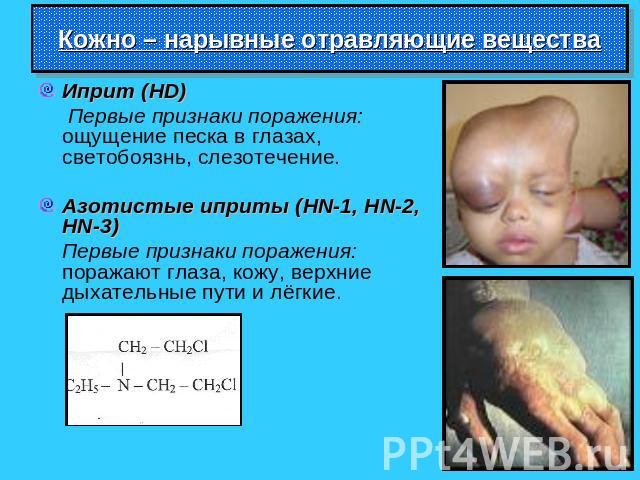 Кожно – нарывные отравляющие вещества Иприт (HD) Первые признаки поражения: ощущение песка в глазах, светобоязнь, слезотечение.Азотистые иприты (HN-1, HN-2, HN-3) Первые признаки поражения: поражают глаза, кожу, верхние дыхательные пути и лёгкие.