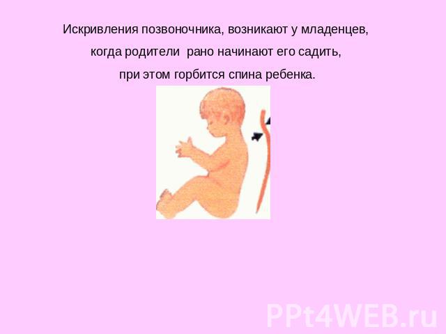 Искривления позвоночника, возникают у младенцев, когда родители рано начинают его садить, при этом горбится спина ребенка.