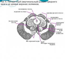 Рис 4. Поперечный (вертикальный) разрез среднего мозга на уровне верхних холмико
