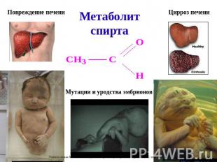 Повреждение печени Метаболит спирта Цирроз печени Мутации и уродства эмбрионов