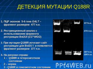 ДЕТЕКЦИЯ МУТАЦИИ Q188R 1. ПЦР экзонов 5-6 гена GALT – фрагмент размером 477 п.н.