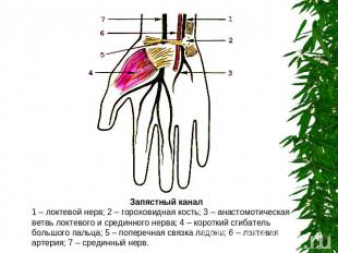 Запястный канал1 – локтевой нерв; 2 – гороховидная кость; 3 – анастомотическая в