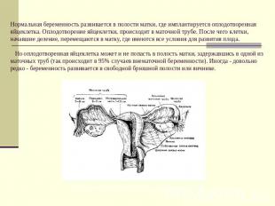 Нормальная беременность развивается в полости матки, где имплантируется оплодотв