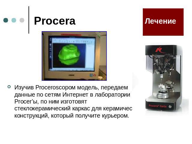 Procera Изучив Proceroscopом модель, передаем данные по сетям Интернет в лаборатории Procer’ы, по ним изготовят стеклокерамический каркас для керамических конструкций, который получите курьером.