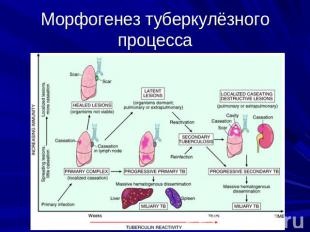 Морфогенез туберкулёзного процесса