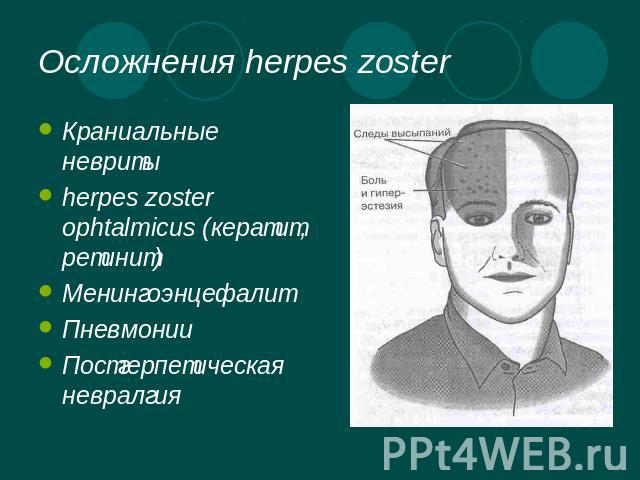 Осложнения herpes zoster Краниальные невритыherpes zoster ophtalmicus (кератит, ретинит)МенингоэнцефалитПневмонии Постгерпетическая невралгия
