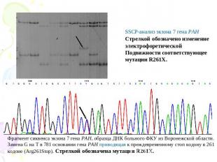 SSCP-анализ экзона 7 гена PAH Стрелкой обозначено изменениеэлектрофоретической П