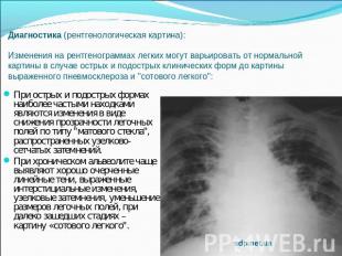 Диагностика (рентгенологическая картина): Изменения на рентгенограммах легких мо