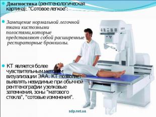 Диагностика (рентгенологическая картина): "Сотовое легкое": Замещение нормальной