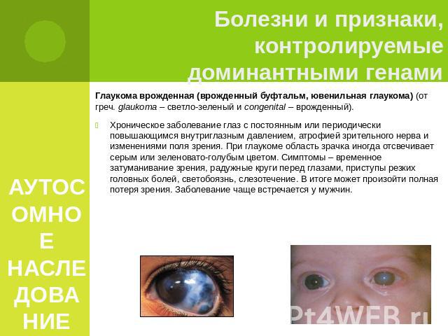 АУТОСОМНОЕ НАСЛЕДОВАНИЕ Глаукома врожденная (врожденный буфтальм, ювенильная глаукома) (от греч. glaukoma – светло-зеленый и congenital – врожденный). Хроническое заболевание глаз с постоянным или периодически повышающимся внутриглазным давлением, а…