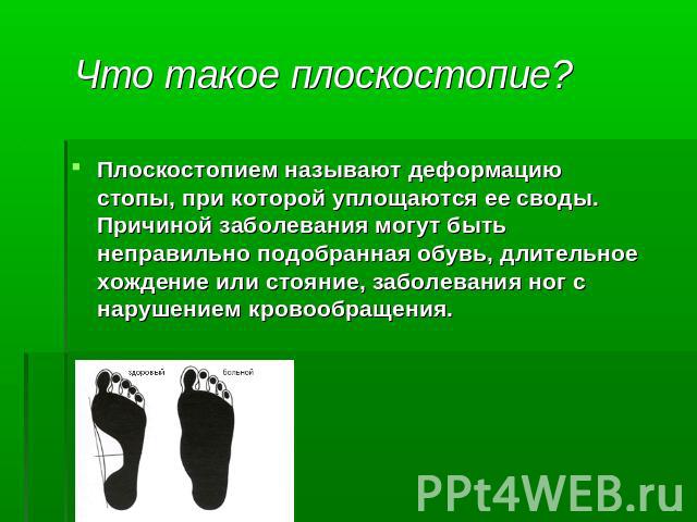 Что такое плоскостопие? Причиной заболевания могут быть неправильно подобранная обувь, длительное хождение или стояние, заболевания ног с нарушением кровообращения.