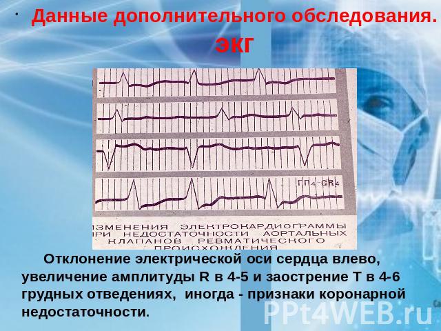 Данные дополнительного обследования. экг Отклонение электрической оси сердца влево, увеличение амплитуды R в 4-5 и заострение Т в 4-6 грудных отведениях, иногда - признаки коронарной недостаточности.