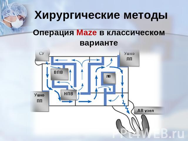 Хирургические методы Операция Maze в классическом варианте