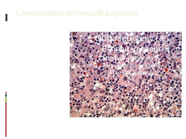 Смешанноклеточный вариант ткань лимфатического узла частично или полностью замещена диффузным клеточным инфильтратом из клеток Б-Ш, лимфоцитов, плазмоцитов, гистиоцитов эозинофилов, нейтрофилов и фибробластов. Клетки Б-Ш могут иметь нетипичное строе…