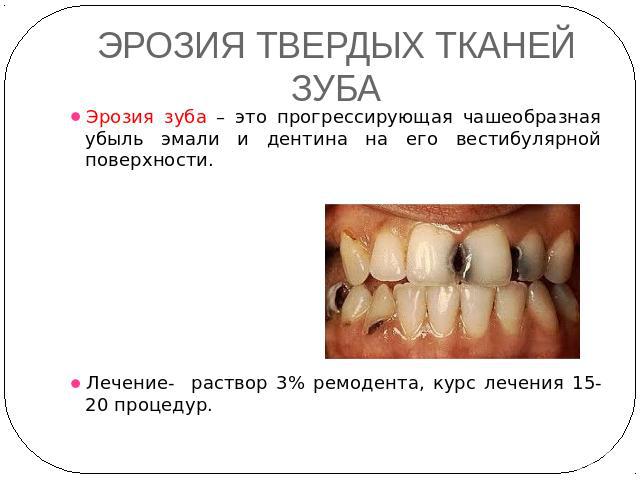 ЭРОЗИЯ ТВЕРДЫХ ТКАНЕЙ ЗУБА Эрозия зуба – это прогрессирующая чашеобразная убыль эмали и дентина на его вестибулярной поверхности. Лечение- раствор 3% ремодента, курс лечения 15-20 процедур.