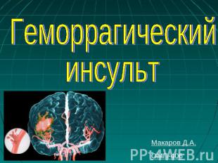 Геморрагический инсульт Макаров Д.А.ОМП-406