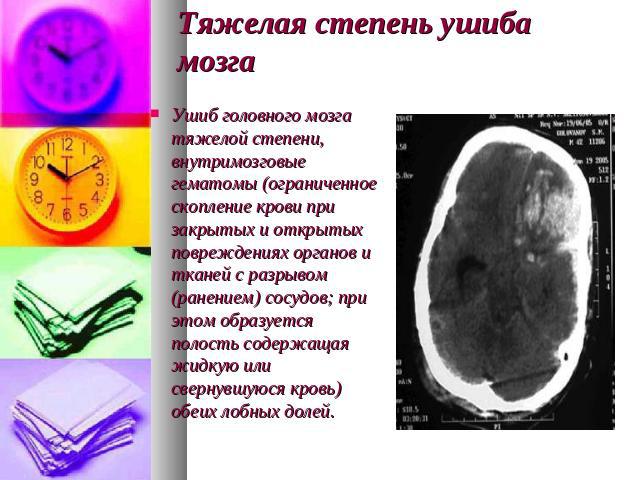 Тяжелая степень ушиба мозга Ушиб головного мозга тяжелой степени, внутримозговые гематомы (ограниченное скопление крови при закрытых и открытых повреждениях органов и тканей с разрывом (ранением) сосудов; при этом образуется полость содержащая жидку…