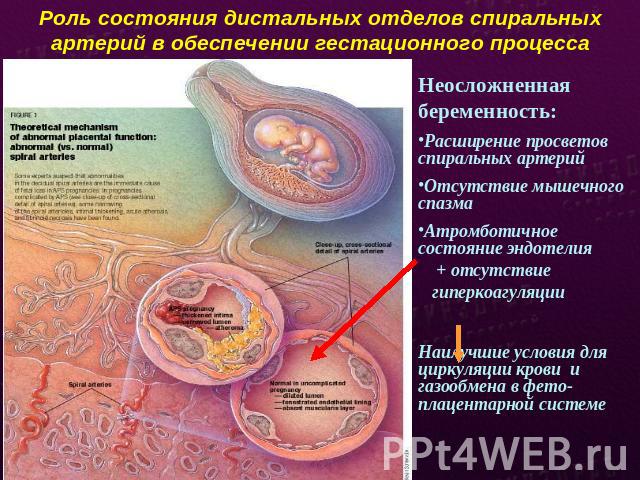 Роль состояния дистальных отделов спиральных артерий в обеспечении гестационного процесса Неосложненная беременность:Расширение просветов спиральных артерий Отсутствие мышечного спазмаАтромботичное состояние эндотелия + отсутствие гиперкоагуляцииНаи…