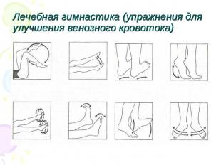 Лечебная гимнастика (упражнения для улучшения венозного кровотока)