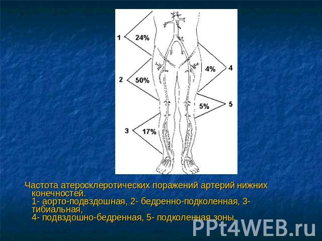Частота атеросклеротических поражений артерий нижних конечностей.1- аорто-подвздошная, 2- бедренно-подколенная, 3- тибиальная,4- подвздошно-бедренная, 5- подколенная зоны.