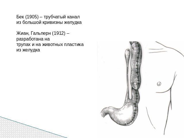 Бек (1905) – трубчатый канализ большой кривизны желудкаЖиан, Гальперн (1912) – разработана на трупах и на животных пластикаиз желудка