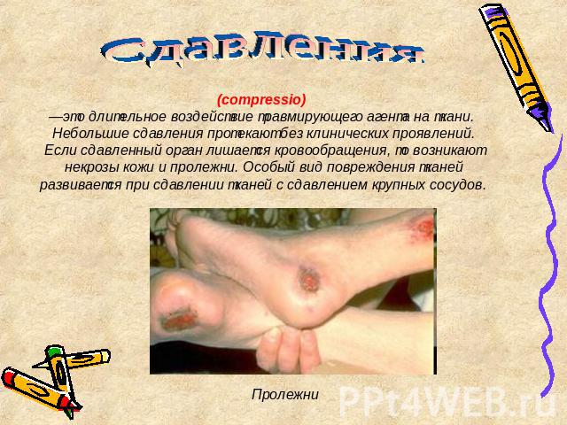 Сдавления (compressio) —это длительное воздействие травмирующего агента на ткани. Небольшие сдавления протекают без клинических проявлений. Если сдавленный орган лишается кровообращения, то возникают некрозы кожи и пролежни. Особый вид повреждения т…