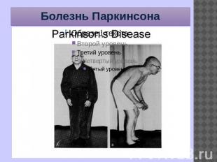 Болезнь Паркинсона