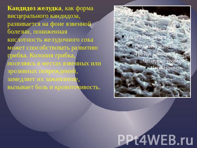 Кандидоз желудка, как форма висцерального кандидоза, развивается на фоне язвенной болезни, пониженная кислотность желудочного сока может способствовать развитию грибка. Колония грибка, поселяясь в местах язвенных или эрозивных повреждений, замедляет…