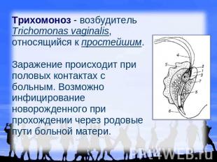 Трихомоноз - возбудитель Trichomonas vaginalis, относящийся к простейшим. Зараже