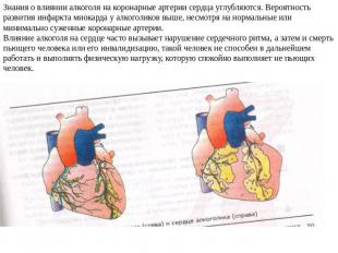 Знания о влиянии алкоголя на коронарные артерии сердца углубляются. Вероятность