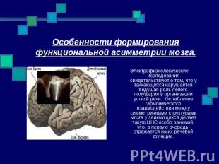 Особенности формирования функциональной асимметрии мозга. Электрофизиологические