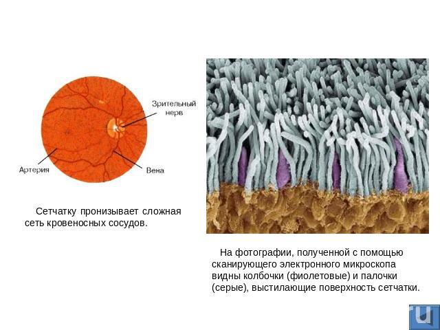 Сетчатку пронизывает сложная сеть кровеносных сосудов. На фотографии, полученной с помощью сканирующего электронного микроскопа видны колбочки (фиолетовые) и палочки (серые), выстилающие поверхность сетчатки.