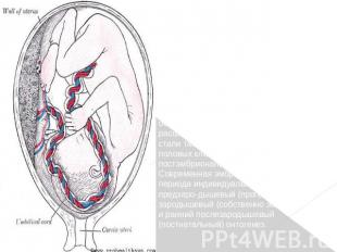 Развитие эмбриологии: Эмбриология (от греч. embrion — зародыш, logos — учение) и
