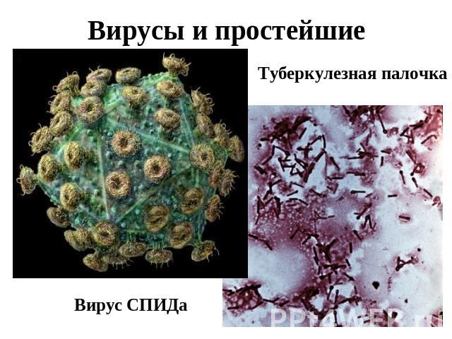 Вирусы и простейшие Туберкулезная палочкаВирус СПИДа