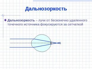 Дальнозоркость Дальнозоркость – лучи от бесконечно удаленного точечного источник