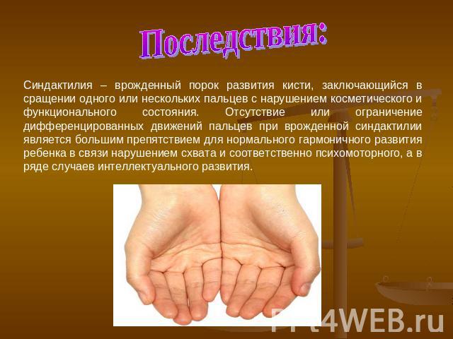 Последствия:Синдактилия – врожденный порок развития кисти, заключающийся в сращении одного или нескольких пальцев с нарушением косметического и функционального состояния. Отсутствие или ограничение дифференцированных движений пальцев при врожденной …