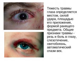 Тяжесть травмы глаза определяется местом, силой удара, площадью его приложения,