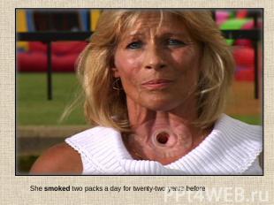 She smoked two packs a day for twenty-two years before