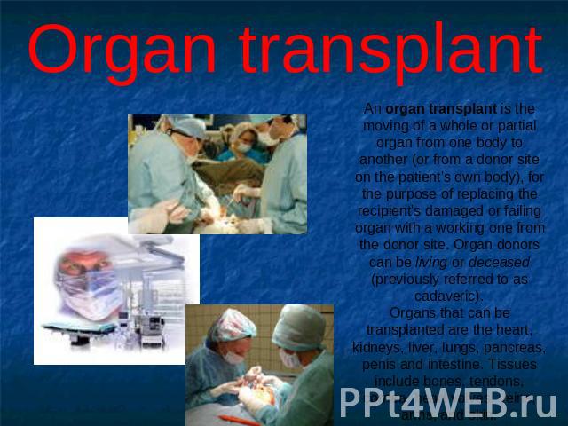 Organ transplant An organ transplant is the moving of a whole or partial organ from one body to another (or from a donor site on the patient's own body), for the purpose of replacing the recipient's damaged or failing organ with a working one from t…