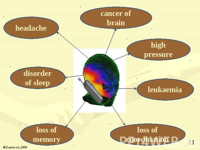 cancer of brain high pressure leukaemia loss of coordinationloss of memory disorder of sleepheadache
