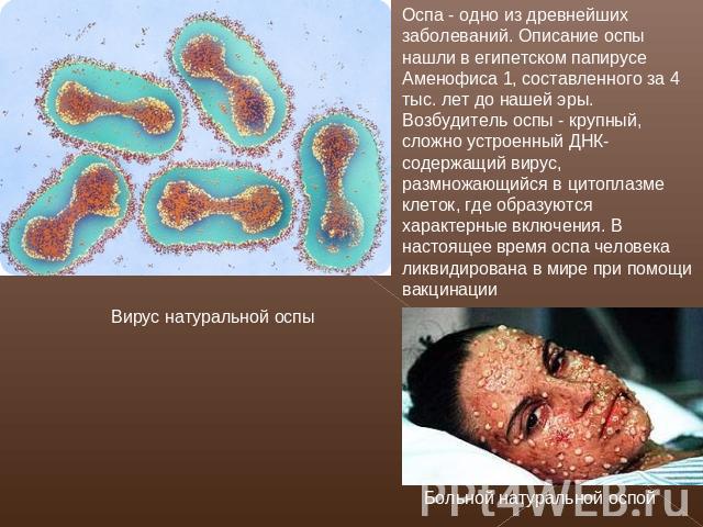 Вирус натуральной оспы Оспа - одно из древнейших заболеваний. Описание оспы нашли в египетском папирусе Аменофиса 1, составленного за 4 тыс. лет до нашей эры. Возбудитель оспы - крупный, сложно устроенный ДНК-содержащий вирус, размножающийся в цитоп…