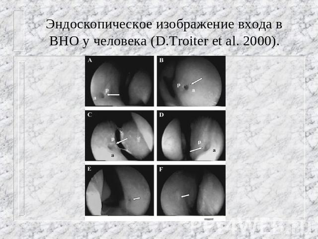 Эндоскопическое изображение входа в ВНО у человека (D.Troiter et al. 2000).