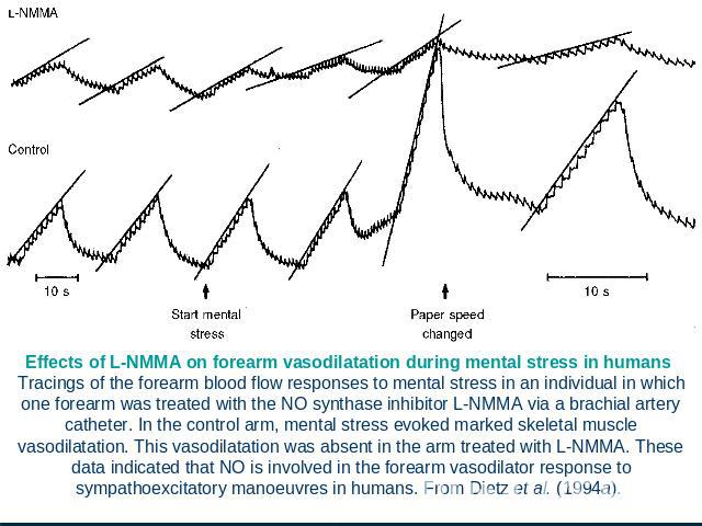 Effects of L-NMMA on forearm vasodilatation during mental stress in humans Tracings of the forearm blood flow responses to mental stress in an individual in which one forearm was treated with the NO synthase inhibitor L-NMMA via a brachial artery ca…