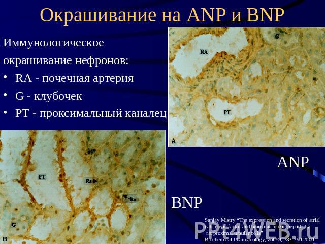 Окрашивание на ANP и BNP Иммунологическое окрашивание нефронов: RA - почечная артерия G - клубочек РТ - проксимальный каналец Sanjay Mistry “The expression and secretion of atrial natriuretic factor and brain natriuretic peptide by rat proximal tubu…